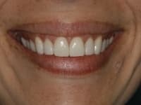 Konig Center for Cosmetic & Comprehensive Dentistry smile photos